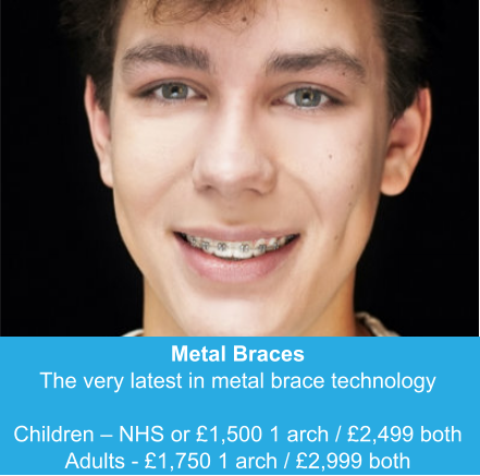 Metal Braces The very latest in metal brace technology  Children – NHS or £1,500 1 arch / £2,499 both Adults - £1,750 1 arch / £2,999 both