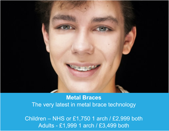 Metal Braces The very latest in metal brace technology  Children – NHS or £1,750 1 arch / £2,999 both Adults - £1,999 1 arch / £3,499 both