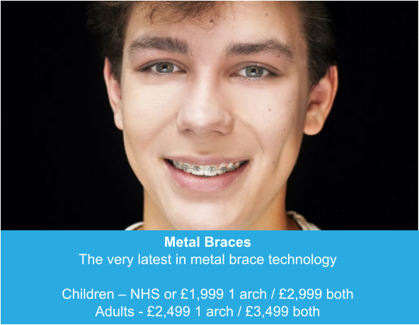 Metal Braces The very latest in metal brace technology  Children – NHS or £1,999 1 arch / £2,999 both Adults - £2,499 1 arch / £3,499 both