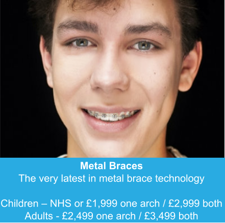 Metal Braces The very latest in metal brace technology  Children – NHS or £1,999 one arch / £2,999 both Adults - £2,499 one arch / £3,499 both