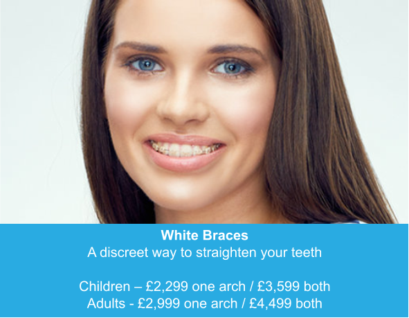 White Braces A discreet way to straighten your teeth  Children – £2,299 one arch / £3,599 both Adults - £2,999 one arch / £4,499 both